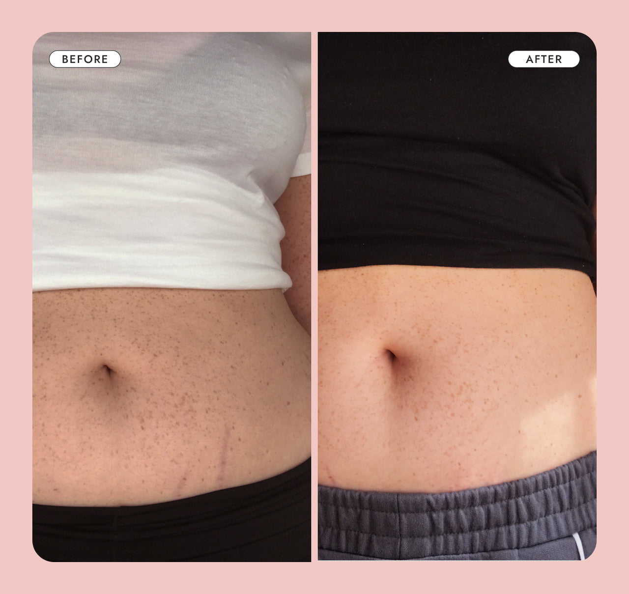 Hinkzy Belly Firming Cream