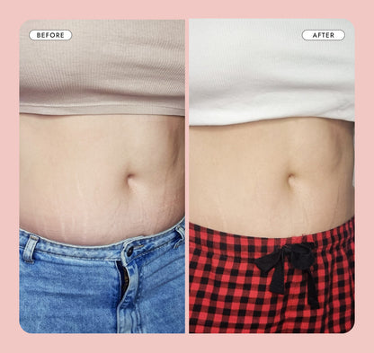 Hinkzy Belly Firming Cream